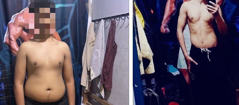 Champion Transformation
